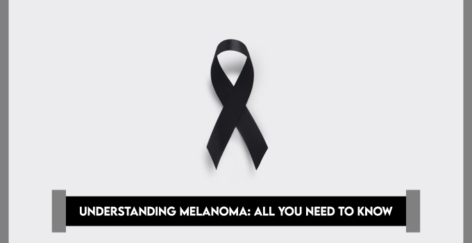 All You Need To Know About Melanoma | MrMed