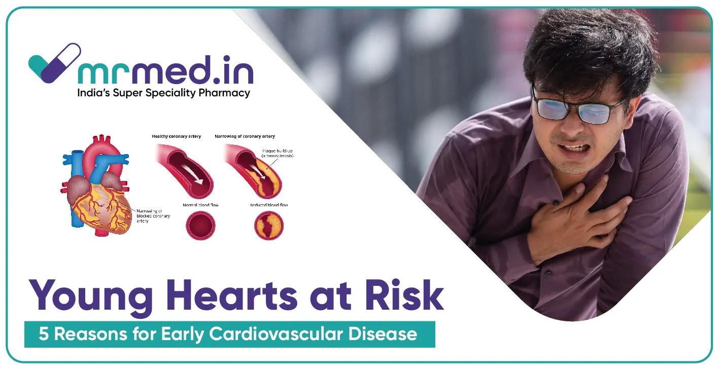 5 Reasons for Early Cardiovascular Disease in Young Adults